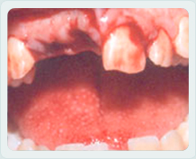 Zahnunfall
